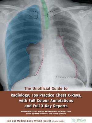 cover image of The Unofficial Guide to Radiology